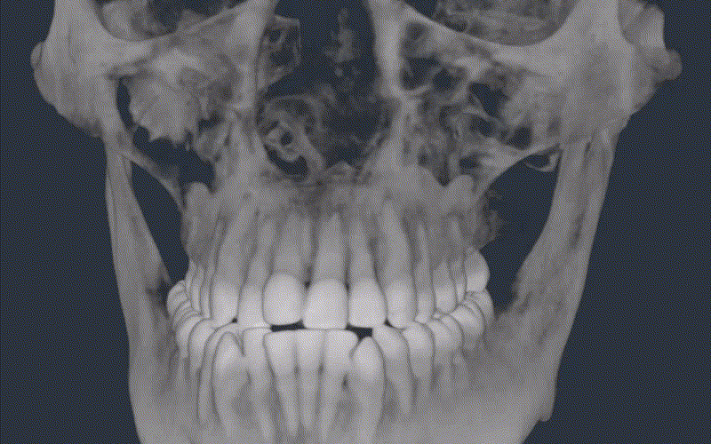 dicom_gif